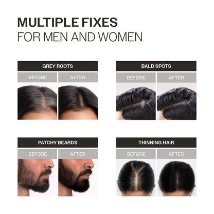 Before and after hair treatment results for men and women with various hair issues.
