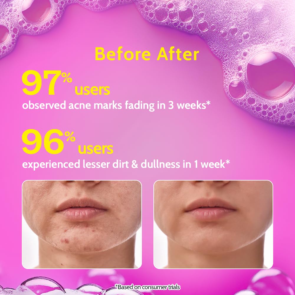 Chemist at Play 2% Salicylic Acid Face Wash For Oily Skin with Niacinamide | Prevents Acne & Removes Excess Oil | Sulphate Free, Anti Acne Face Cleanser | For Men & Women | 100 ml