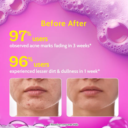 Chemist at Play 2% Salicylic Acid Face Wash For Oily Skin with Niacinamide | Prevents Acne & Removes Excess Oil | Sulphate Free, Anti Acne Face Cleanser | For Men & Women | 100 ml