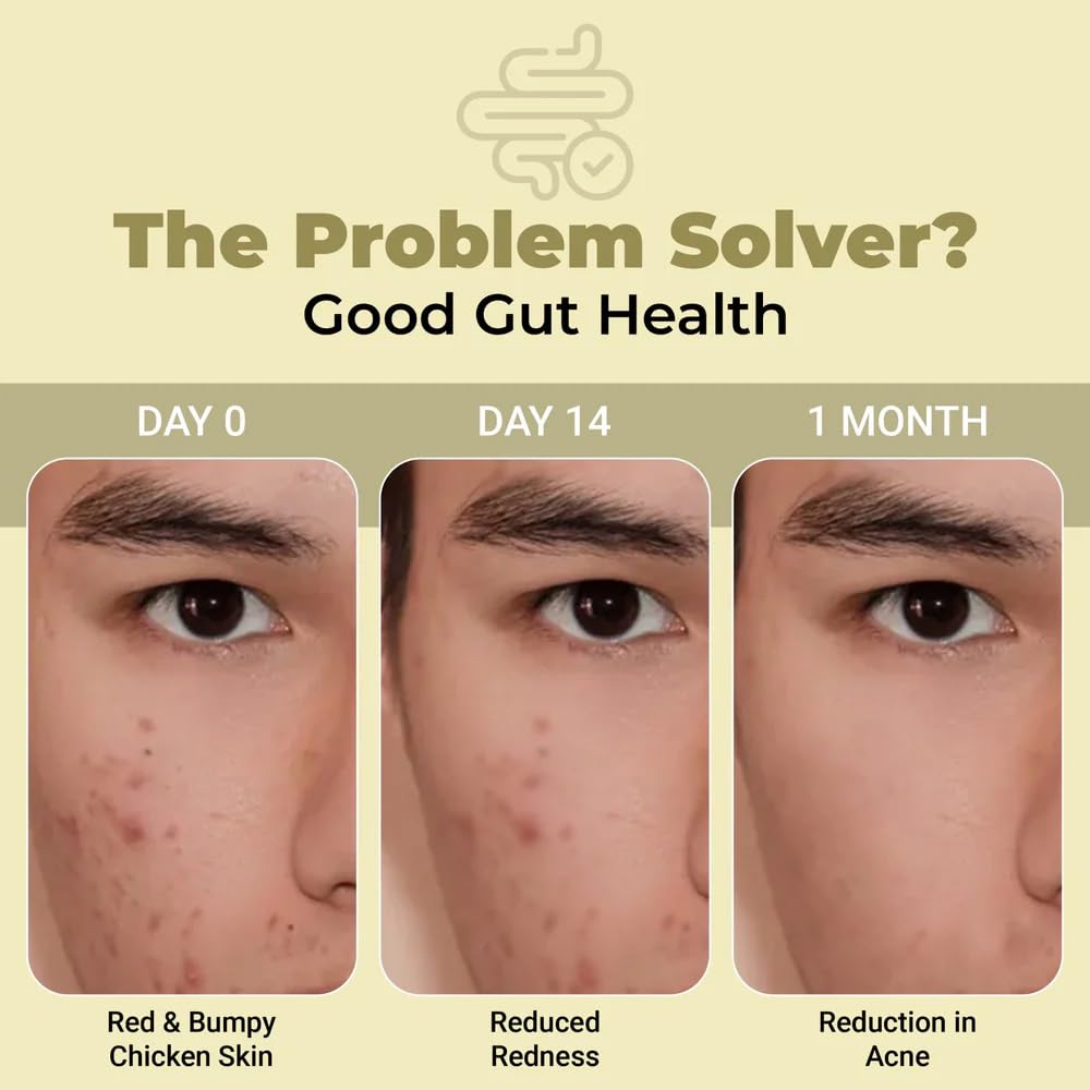 Before-and-after comparison of skin conditions with text 'The Problem Solver? Good Gut Health' on a beige background.