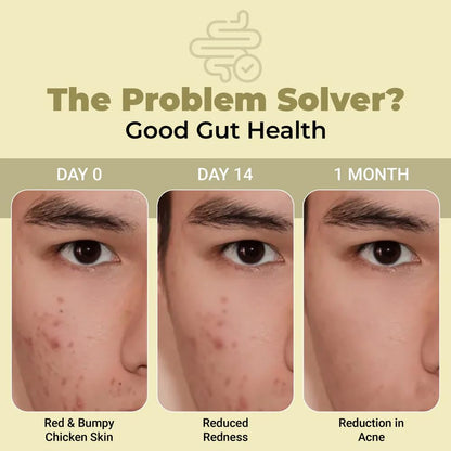 Before-and-after comparison of skin conditions with text 'The Problem Solver? Good Gut Health' on a beige background.