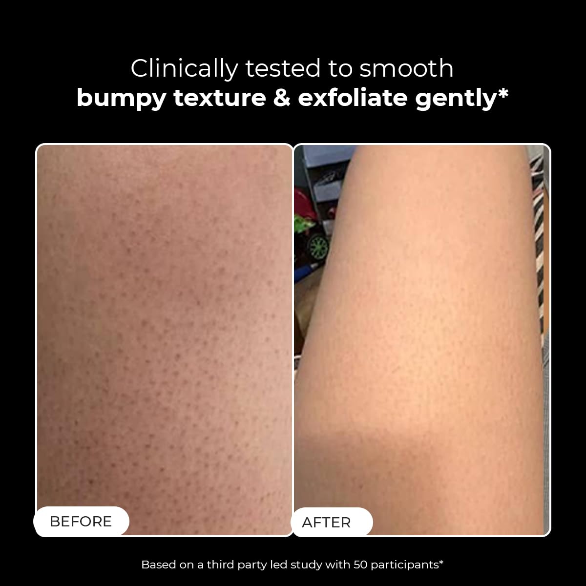 Before and after comparison of skin texture with text indicating clinical testing.