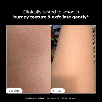 Before and after comparison of skin texture with text indicating clinical testing.
