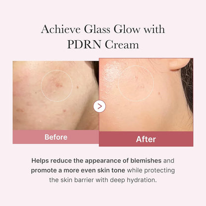 Medicube Salmon DNA PDRN Pink Hyaluronic Moisturizing Cream | Blemish Relief & Hydrating Care | Restores Skin Elasticity & Glow | Korean Skincare, Even Skin Tone & Pore Care | 50ml