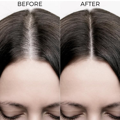 Brillare Caffeine Anti Hair Fall Shampoo | Boost Hair Growth with Caffeine & Peptides for Men & Women