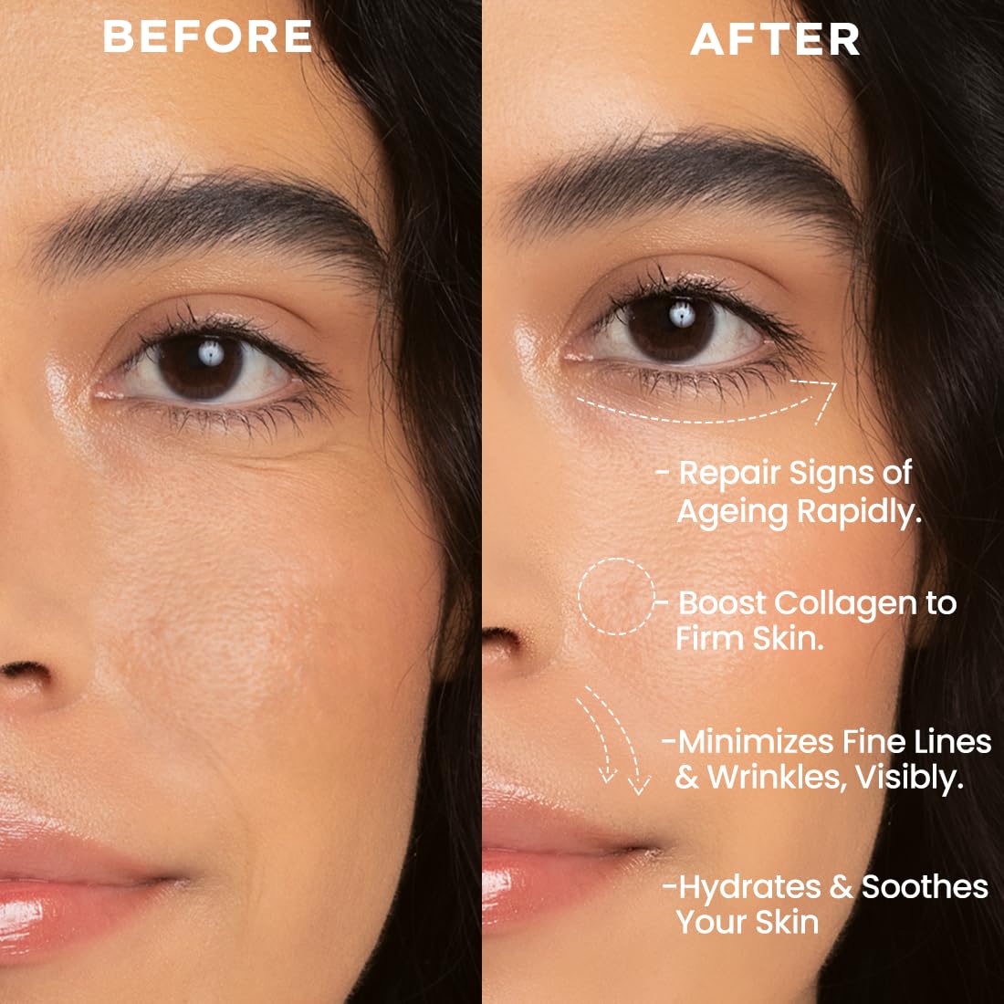 Before and after comparison of skin treatment with text highlighting benefits.