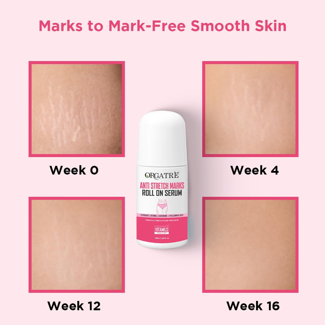 Orgatre Anti Stretch Marks Roll On Serum for Women With Striover | Retinol, Ceramide & Hyaluronic Acid | Lightweight & Non-Greasy | Reduces Stretch Marks & Boosts Elasticity | Safe for Pregnancy | 50ml