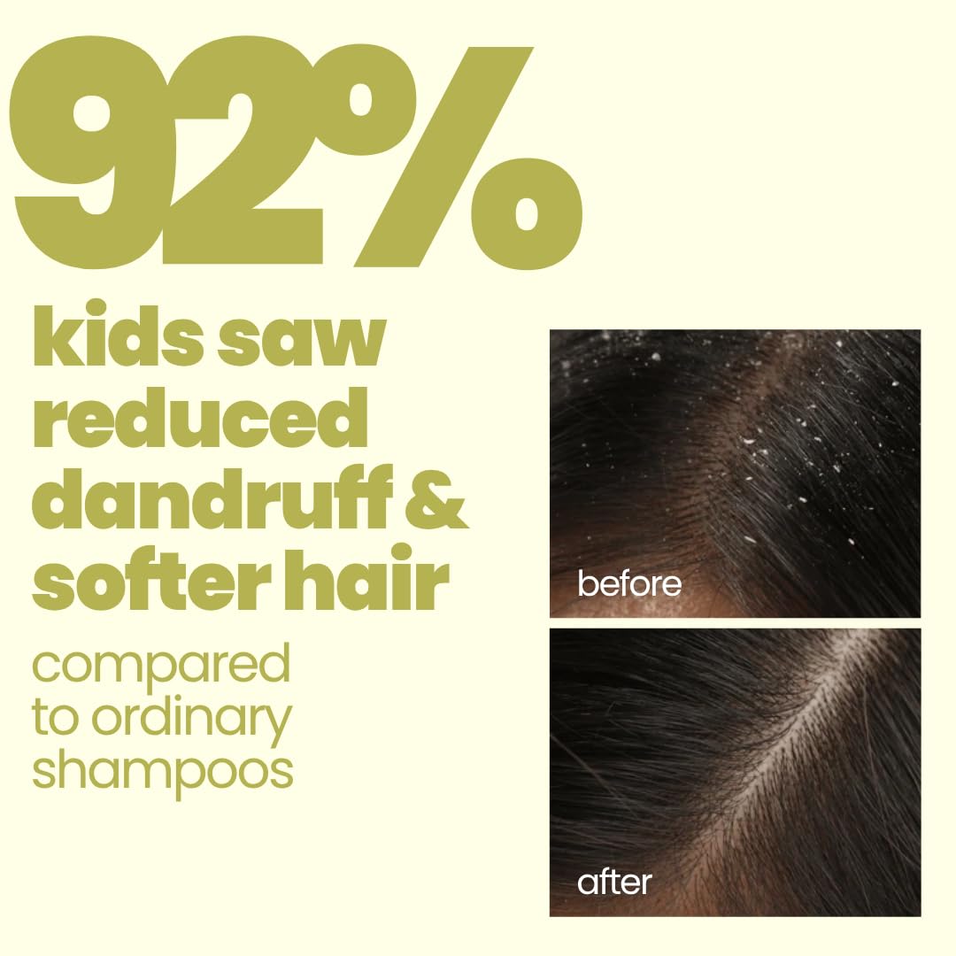 Advertisement showing before and after hair comparison with text about dandruff reduction and softer hair.