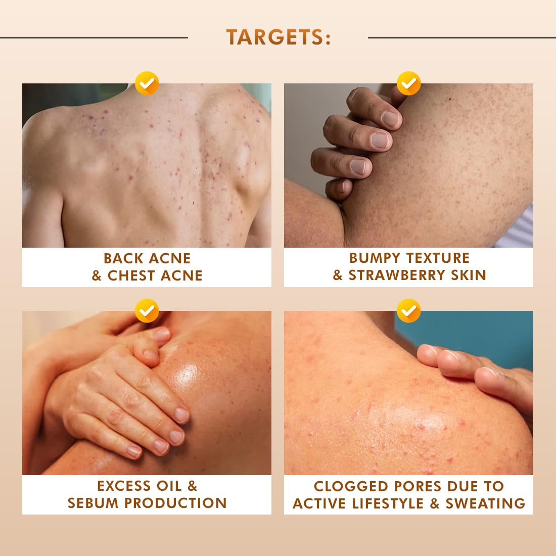Product targeting back acne, chest acne, bumpy texture, strawberry skin, excess oil, and clogged pores on skin.