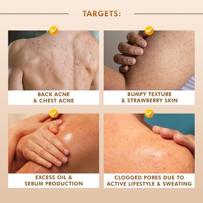 Product targeting back acne, chest acne, bumpy texture, strawberry skin, excess oil, and clogged pores on skin.