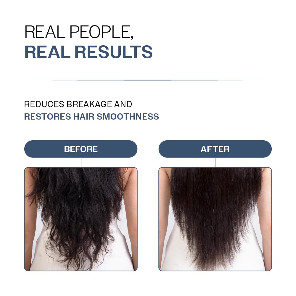 Bare Anatomy Anti-Hair Fall Shampoo (250ml) & Anti-Hair Fall Conditioner Combo (175ml) | Provides 5X Hair Fall Control | Adenosine, Redensyl, Rosemary & Peptides | Strengthens Roots & Reduces Breakage