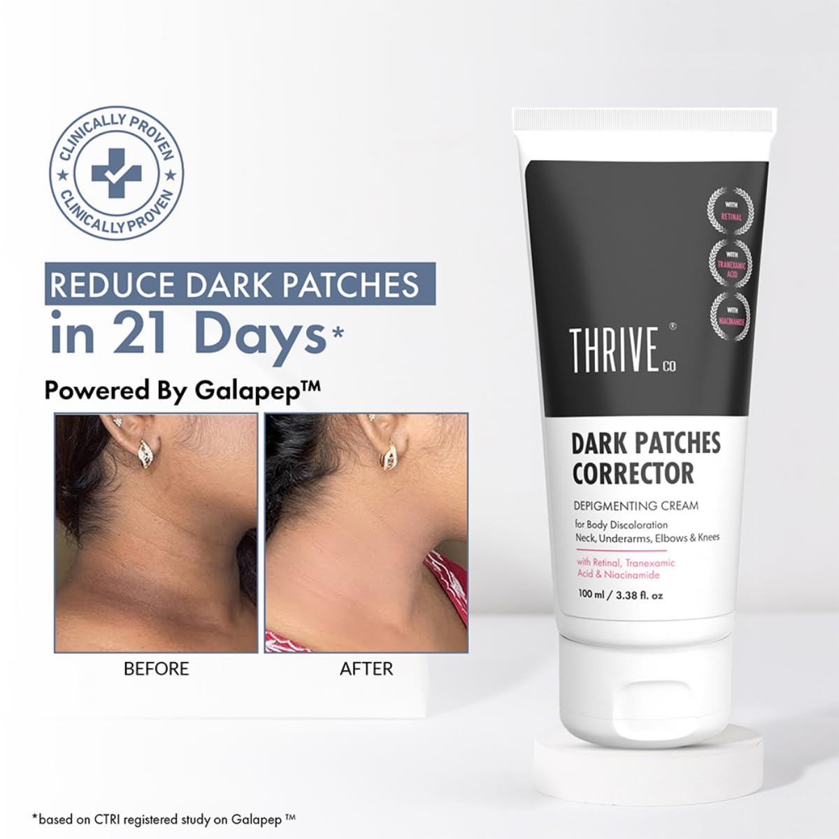 Thrive Dark Patches Corrector cream with before and after results on a white background