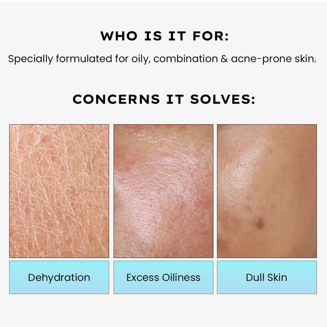 Product description for oily, combination, and acne-prone skin with skin texture images and text.