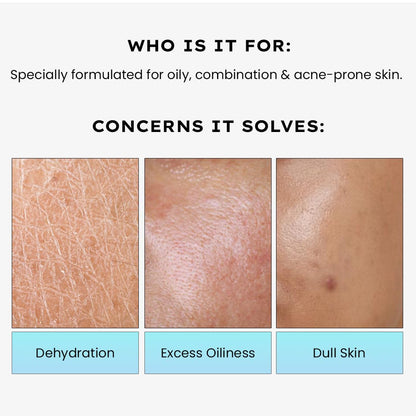 Product description for oily, combination, and acne-prone skin with skin texture images and text.