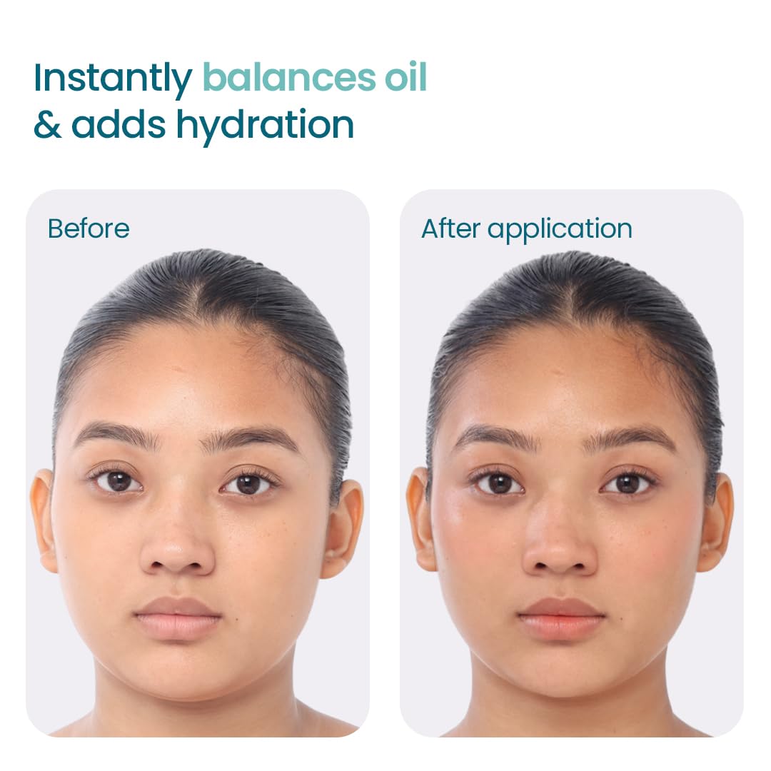 Before and after application of a product to balance oil and add hydration.