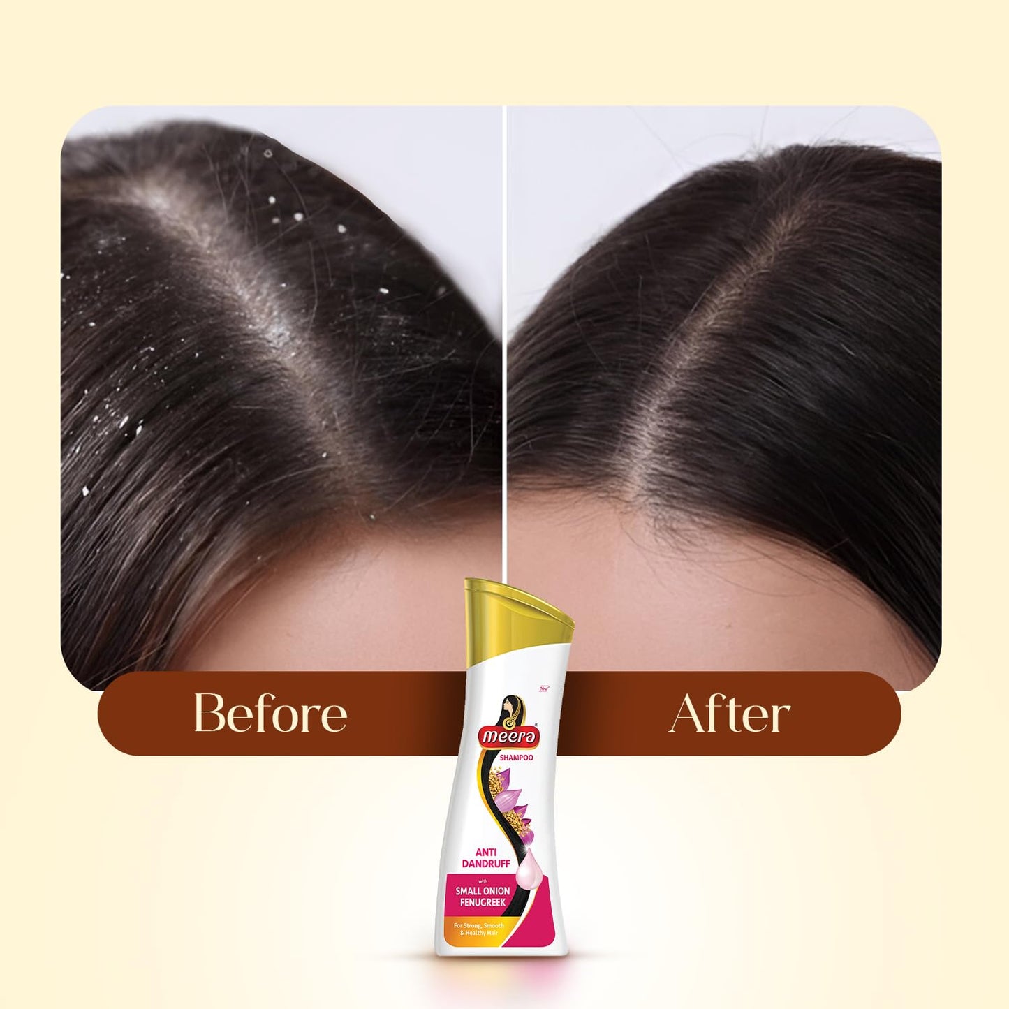 Meera Anti-Dandruff Shampoo, With Small Onion and Fenugreek, 180 ml