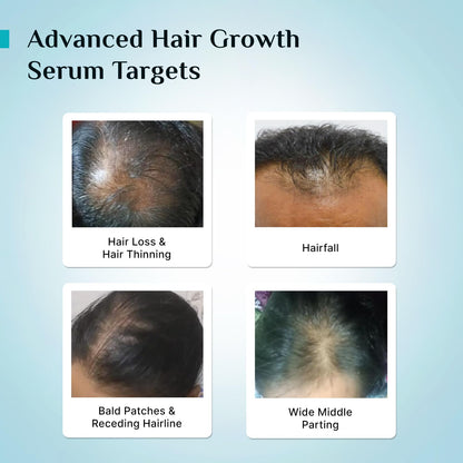 PILGRIM Redensyl 3%+Anagain 4% Advanced Hair Growth Serum For Scalp(50Ml) With Natural Ingredients Korean Black Rice,Controls Hair Fall,Stimulates,Increases Hair Density|Hairgrowth Serum For Unisex
