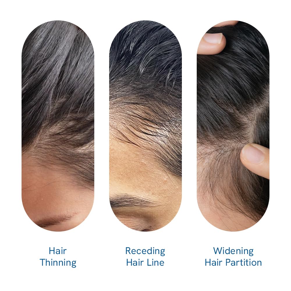 Be Bodywise Rosemary Hair Growth Serum (Roll On)|Promotes Hair Growth & Stimulates Hair Follicles |3% Rosemary, 3% Redensyl & 2% Anagain | Hair Fall Control Serum For Unisex |For All Hair Types | 50Ml