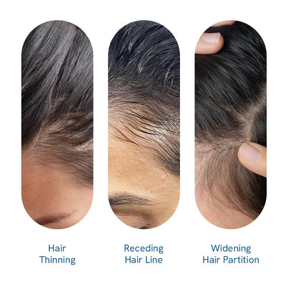 Be Bodywise Rosemary Hair Growth Serum (Roll On)|Promotes Hair Growth & Stimulates Hair Follicles |3% Rosemary, 3% Redensyl & 2% Anagain | Hair Fall Control Serum For Unisex |For All Hair Types | 50Ml