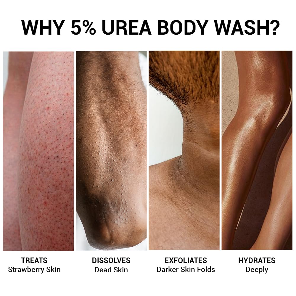 Collage of skin conditions treated by 5% urea body wash with text describing its benefits.