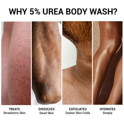 Collage of skin conditions treated by 5% urea body wash with text describing its benefits.