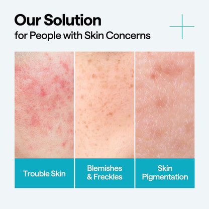 MEDIHEAL Madecassoside Repair Serum, Korean Face Serum with Centella Asiatica & Niacinamide for Blemish Repair, Fades Pigmentation, Dark Spot & Freckles, Soothing Hydrating Skin Barrier Repair Serum (40ml)
