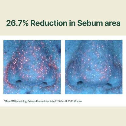 [PKY] Pyunkang Yul Calming Moisture Serum Instantly Soothes Sensitive Skin, Strenghtens Moisture Barrier with Ceramide, 2 types of Peptides, Vegan, Korean skincare (30ml)