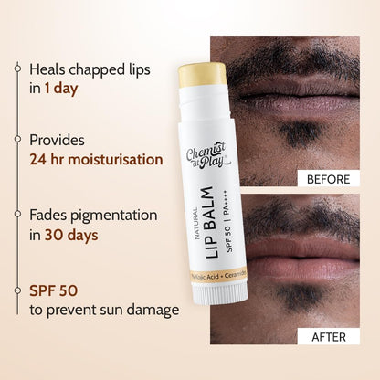 Chemist At Play Natural Lip Balm with SPF 50 PA++++ | 4.5 g, 1% Kojic Acid & Ceramides | Lip balm for Dark and Dry Lips | Brightening Lip Balm | Removes Pigmentation | For Men & Women