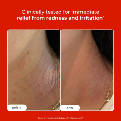 Before and after comparison of skin redness and irritation with a red background and text about clinical testing.