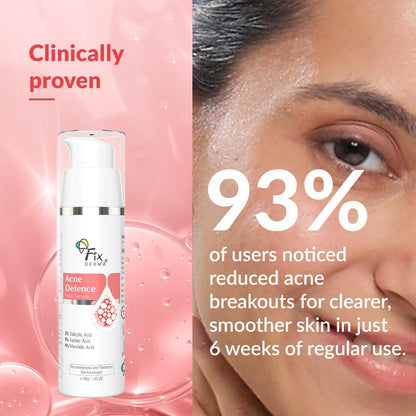 Fixderma 2% Salicylic Acid Serum for Anti Acne & Spot Treatment with 5% Azelaic Acid & 4% Mandelic Acid | Anti Acne Face Serum | Face Serum for Men & Women - 30 gm