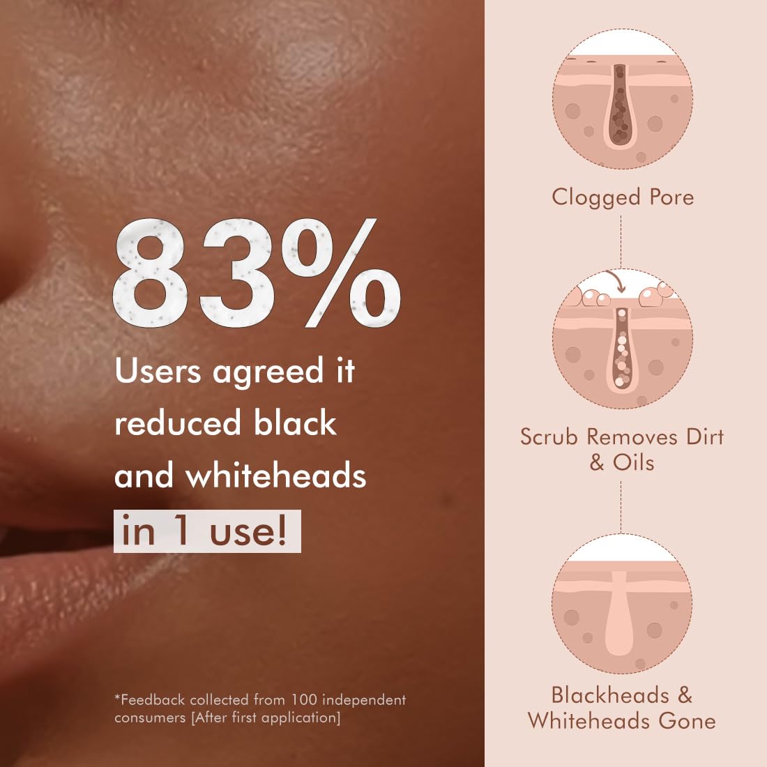 Product advertisement showing skin with blackheads and whiteheads, scrub removes dirt and oils, and 83% of users agreed it reduced black and whiteheads in one use.