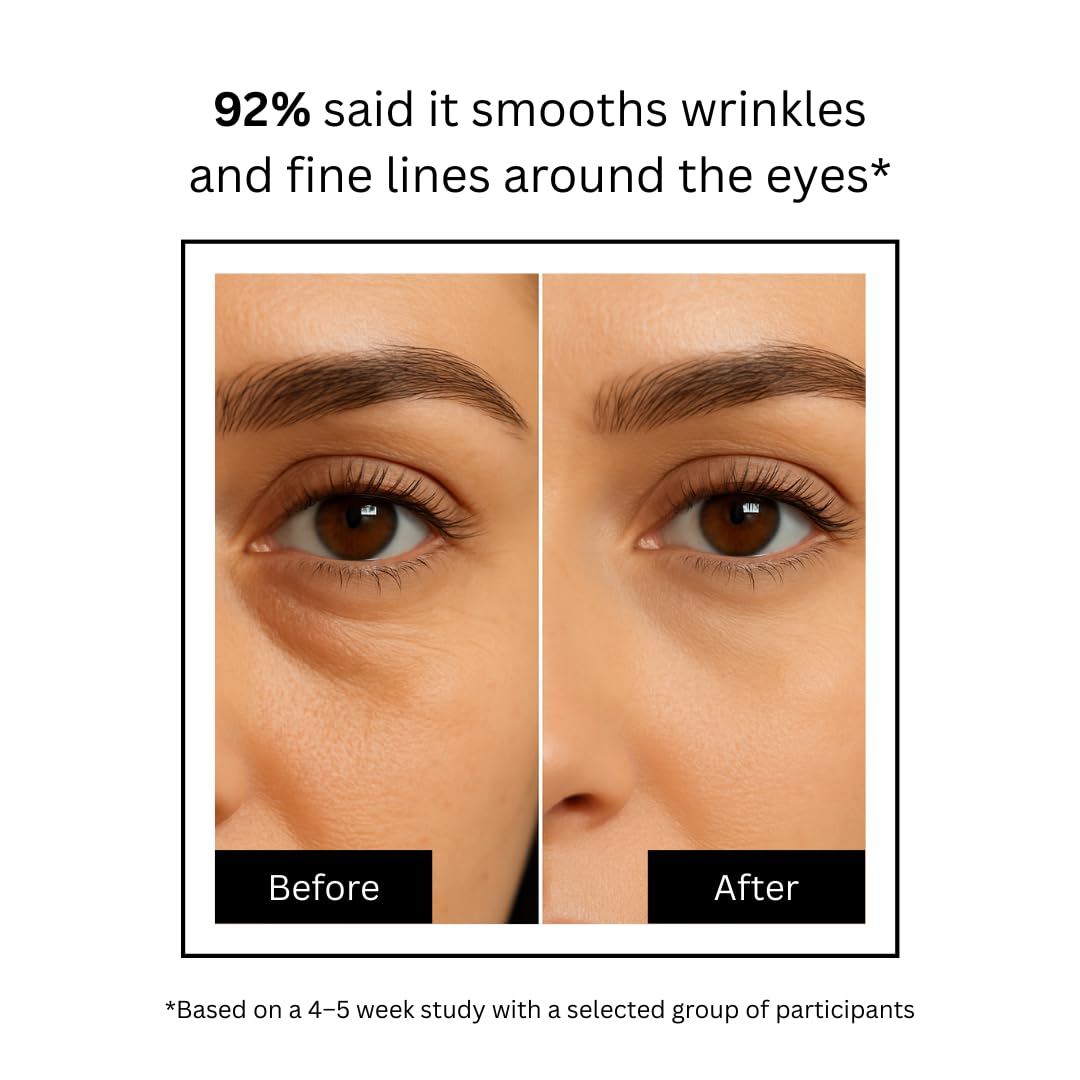 Brilliance Advance Under Eye Serum for Dark Circles & Puffiness – Hydrating Anti-Aging Formula with Peptides,Niacinamide & Hyaluronic Acid | Dermatologist Tested | 15gm