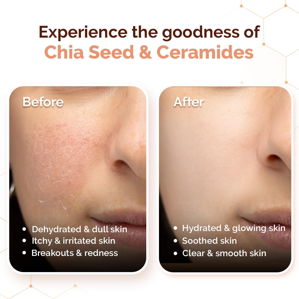 Mamaearth Chia Oil-Free Moisturizer with Chia Seed & Ceramides for Normal to Oily Skin | For Hydrated Glow | 24 Hrs Long-Lasting Hydration | Co-Created with Dermats | Healthy Skin Barrier | Oil-Free Formula | Fragrance Free | 80 g