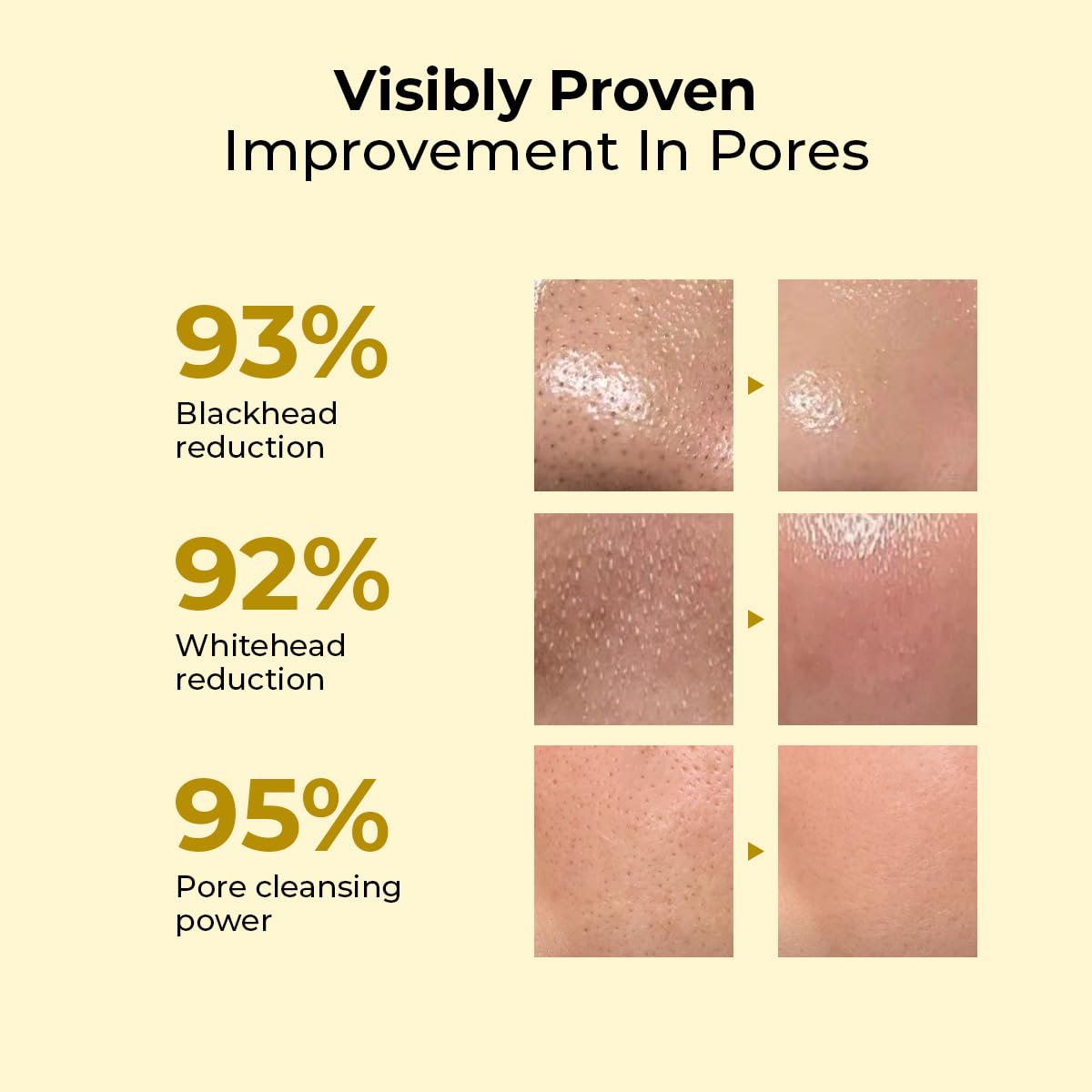 Advertisement showing visibly proven improvement in pores with percentages for blackhead reduction, whitehead reduction, and pore cleansing power.