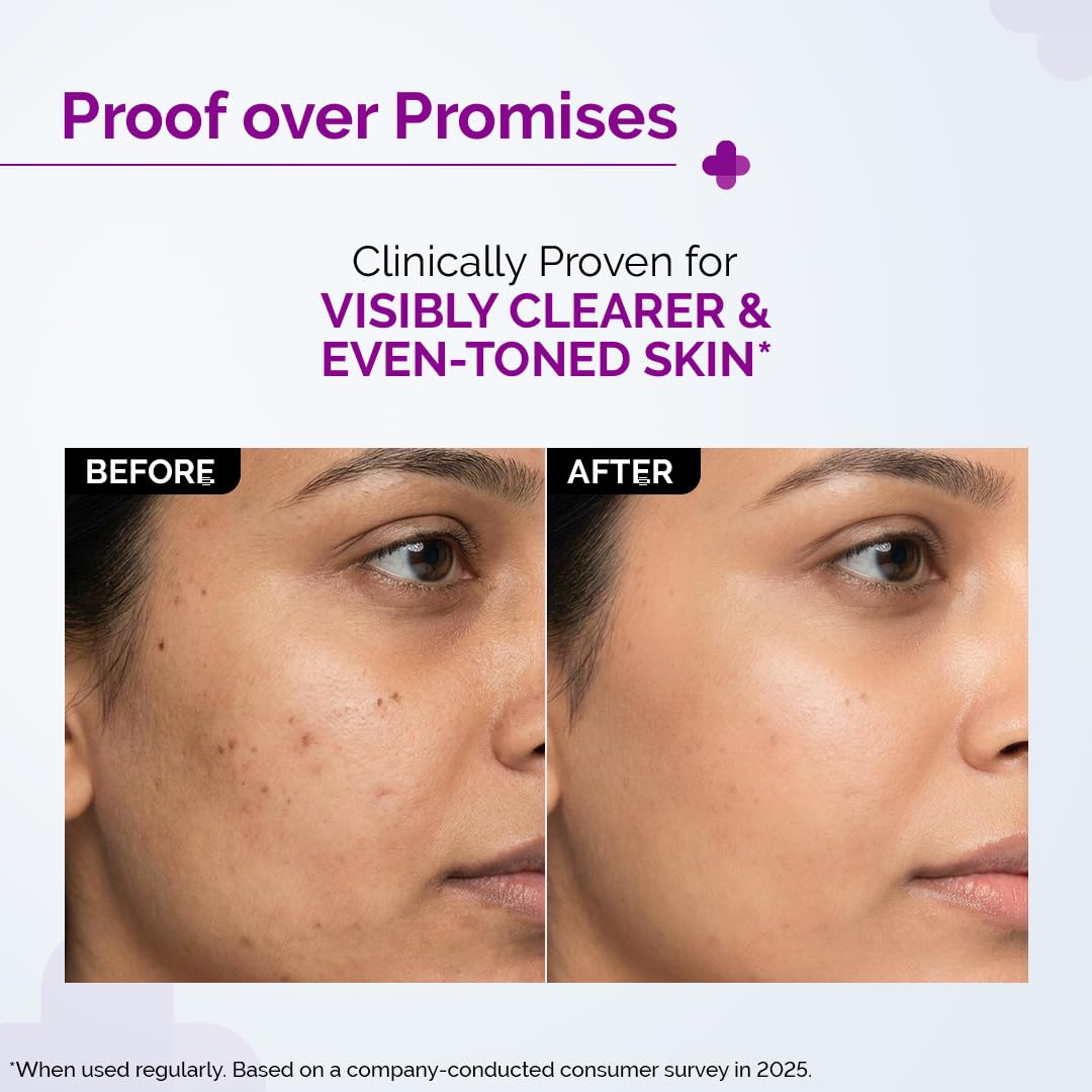 The Derma Co 10% Niacinamide Serum with 2% Zinc, Powered by Deep Penetration Formula™ | Fades Acne Marks, Controls Oil & Reduces Dark Spots | 10 ml