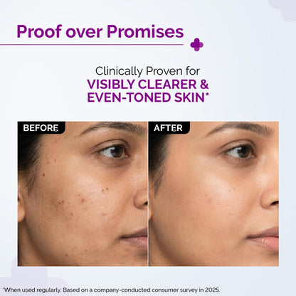 The Derma Co 10% Niacinamide Serum with 2% Zinc, Powered by Deep Penetration Formula™ | Fades Acne Marks, Controls Oil & Reduces Dark Spots | 10 ml