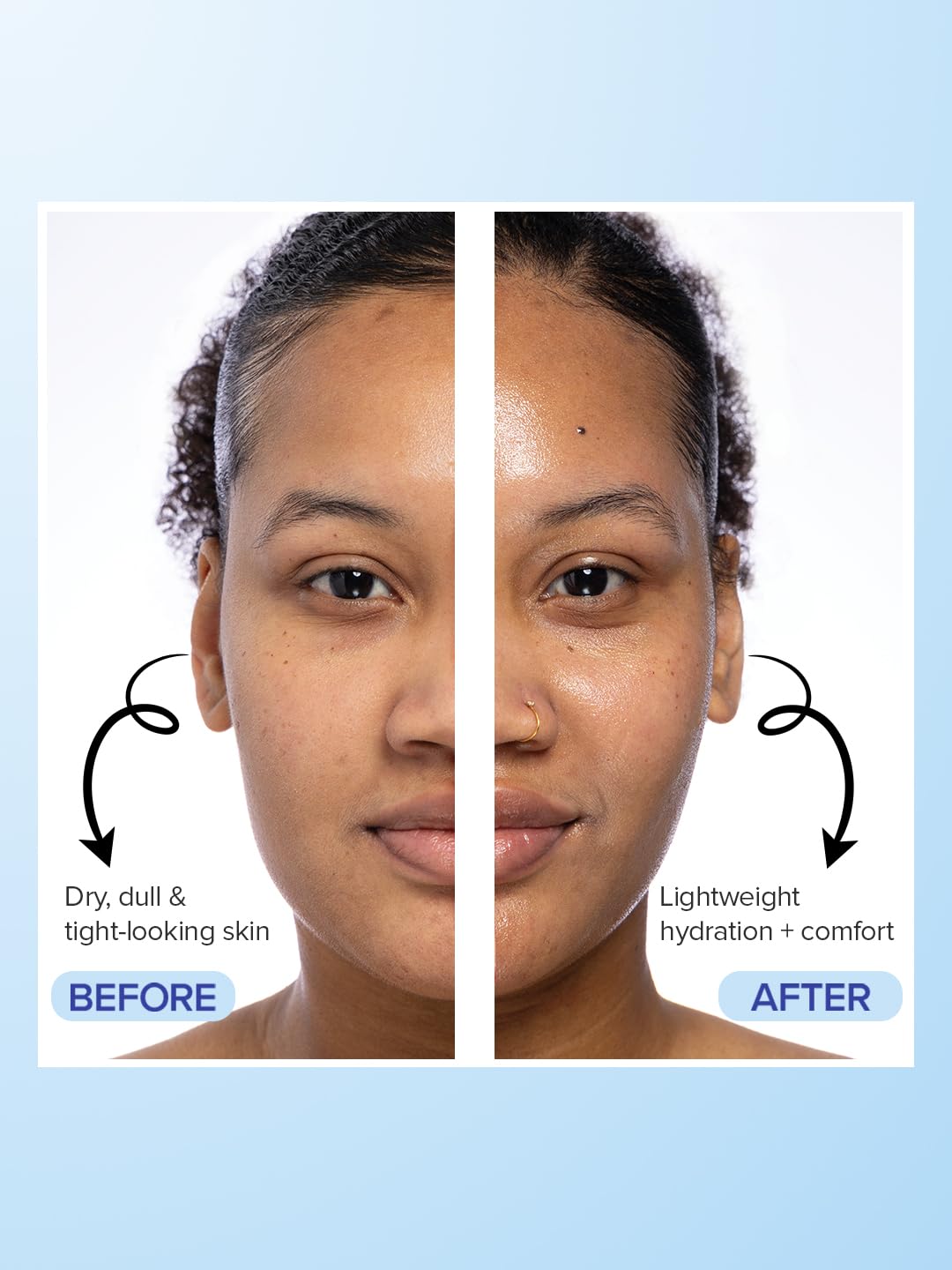 Before and after comparison of a woman's face with text indicating skin improvement.
