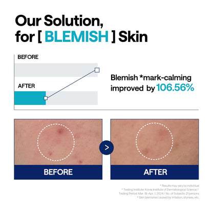 MEDIHEAL Madecassoside Repair Serum, Korean Face Serum with Centella Asiatica & Niacinamide for Blemish Repair, Fades Pigmentation, Dark Spot & Freckles, Soothing Hydrating Skin Barrier Repair Serum (40ml)