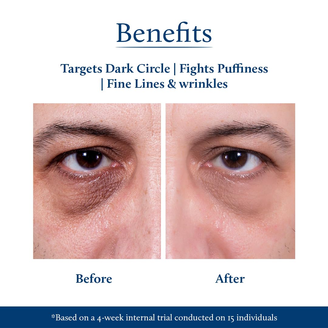 Blue Nectar Under Eye Cream for Dark Circles for Men | Natural Niacinamide Cream from Papaya & Potato | Effective for Wrinkles, Fine Lines & Puffiness (19 Herbs,15gm)