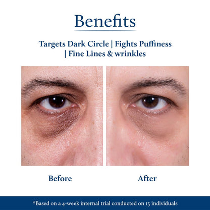 Blue Nectar Under Eye Cream for Dark Circles for Men | Natural Niacinamide Cream from Papaya & Potato | Effective for Wrinkles, Fine Lines & Puffiness (19 Herbs,15gm)