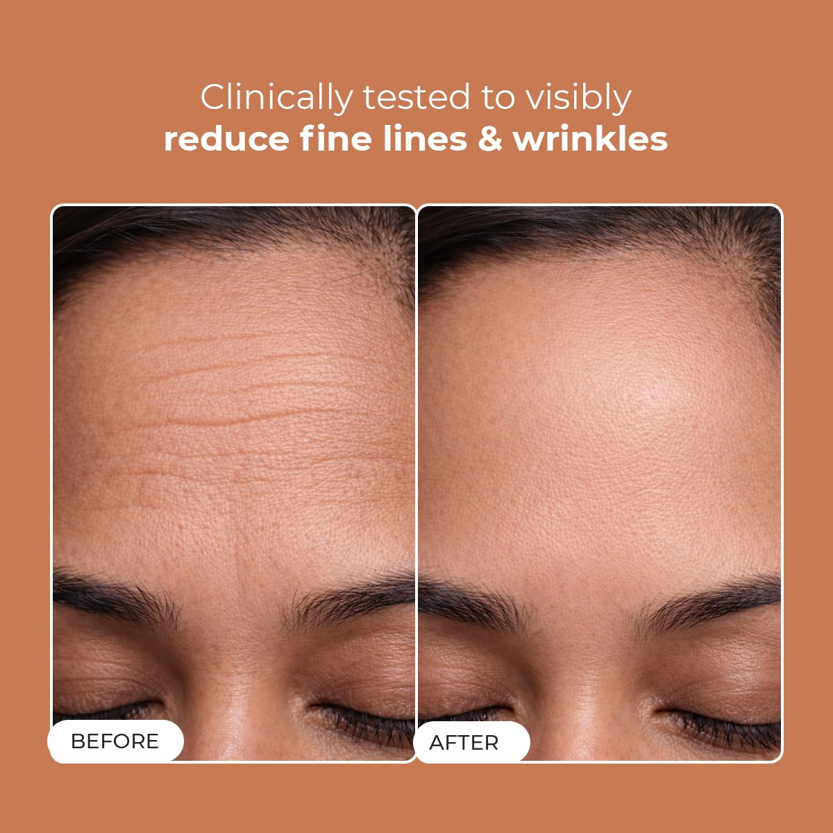 Before and after comparison of fine lines and wrinkles on a person's face with a brown background.