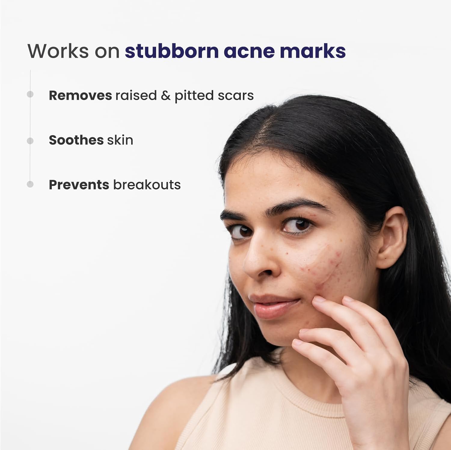 Woman with acne on her face, with text about product benefits on a white background