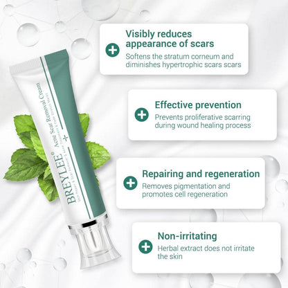 CLUB BOLLYWOOD® Removal Scar Cream Face Pimples Scar Stretch Marks Removal Acne Treatment | Bath & Body | Scar & Stretch Mark Reducers