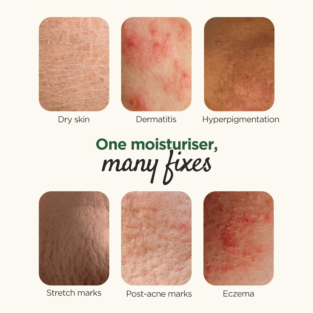 Elovera Moisturising Cream 150g | For Dry Skin | with Aloe Vera & Vitamin E | Protects, Nourishes and Repairs Skin | Paraben Free | Fragrance Free