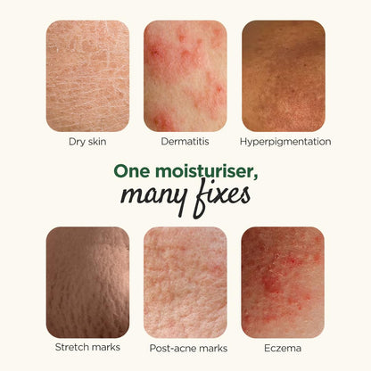 Elovera Moisturising Cream 150g | For Dry Skin | with Aloe Vera & Vitamin E | Protects, Nourishes and Repairs Skin | Paraben Free | Fragrance Free