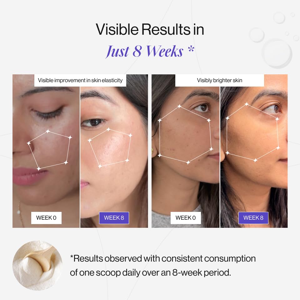 Before and after effects of a skincare product on a woman's face, showing visible improvement in skin elasticity and brightness.