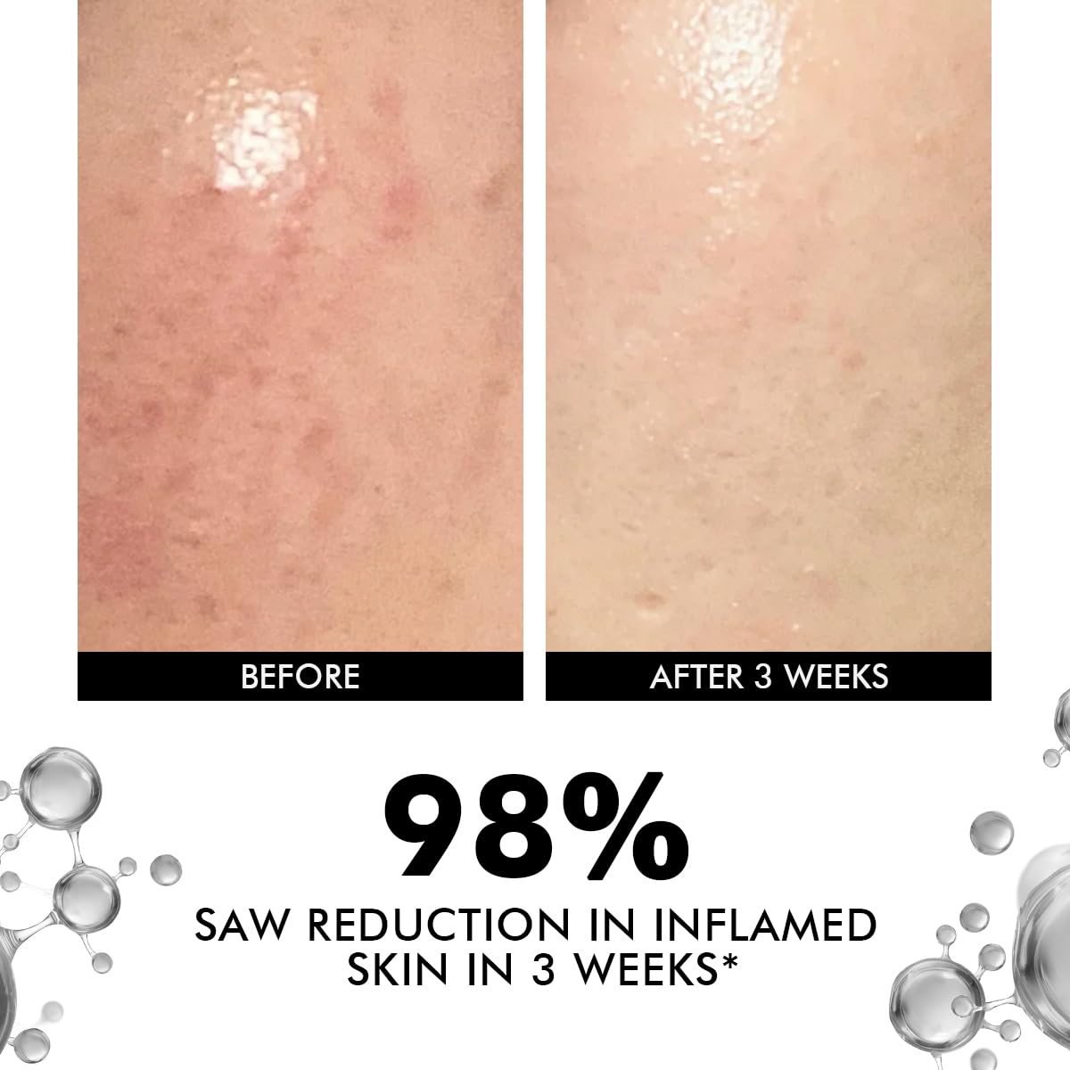 Before and after comparison of inflamed skin with text indicating 98% reduction in inflammation.