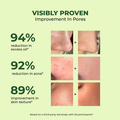 Advertisement showing improvements in pores with percentages and before-and-after images on a green background.