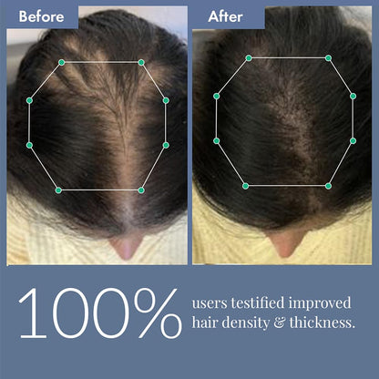 Before and after comparison of hair density and thickness with geometric measurements.