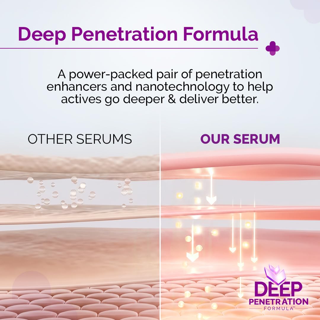 The Derma Co 10% Niacinamide Serum with 2% Zinc, Powered by Deep Penetration Formula™ | Fades Acne Marks, Controls Oil & Reduces Dark Spots | 10 ml